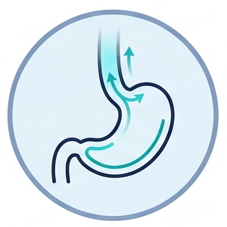 Illustration du reflux et des régurgitations pouvant être associés à une hernie hiatale